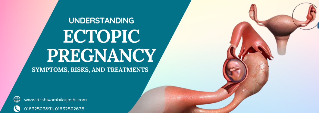 ectopic pregnancy